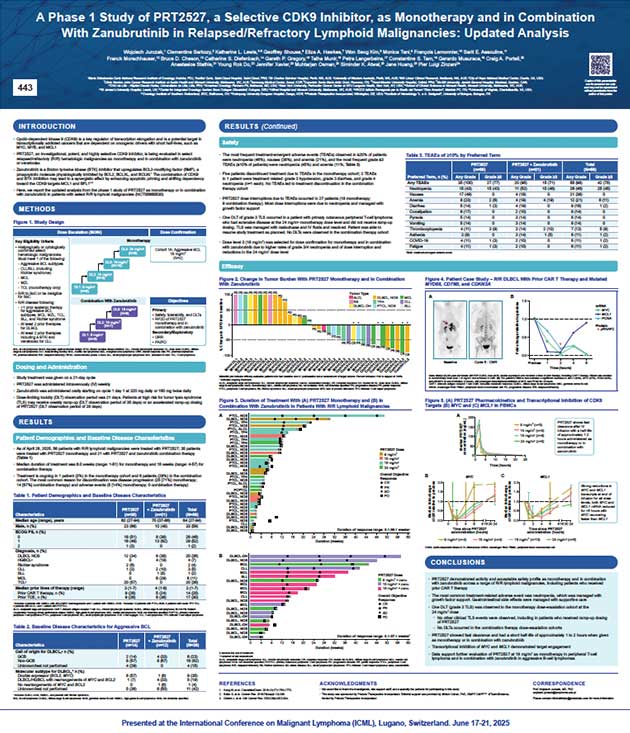 A-Phase-1-Study-of-PRT2527,-a-Selective-CDK9-Inhibitor,-as-Monotherapy-and-in-Combination-With-Zanubrutinib-in-Relapsed---Refractory-Lymphoid-Malignancies--Updated-Analysis-thumb